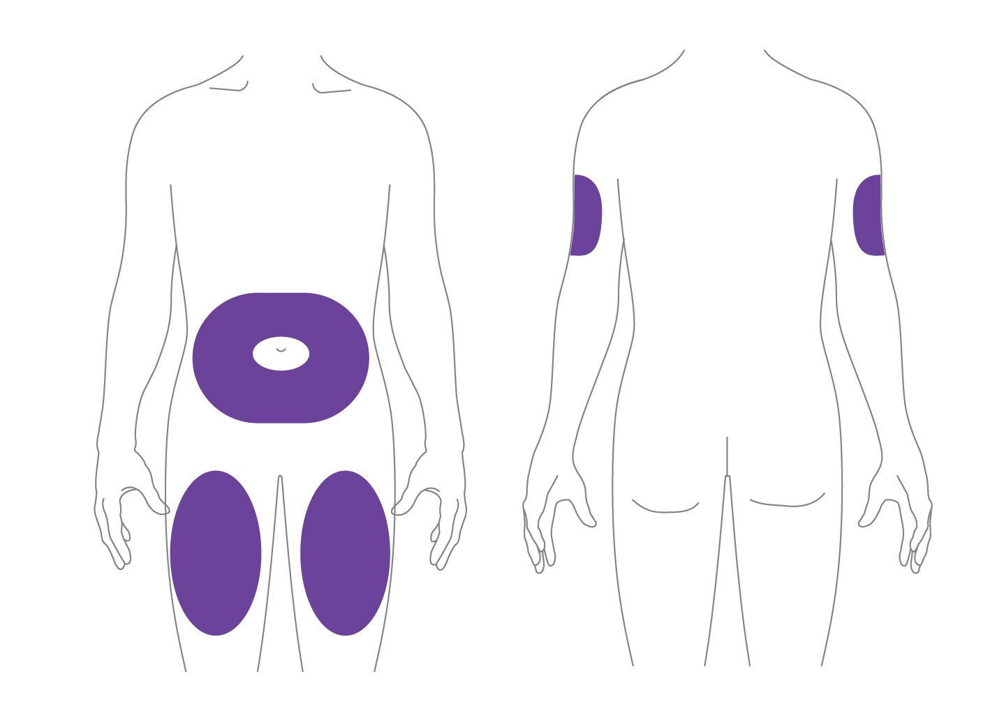 Injection site diagrams