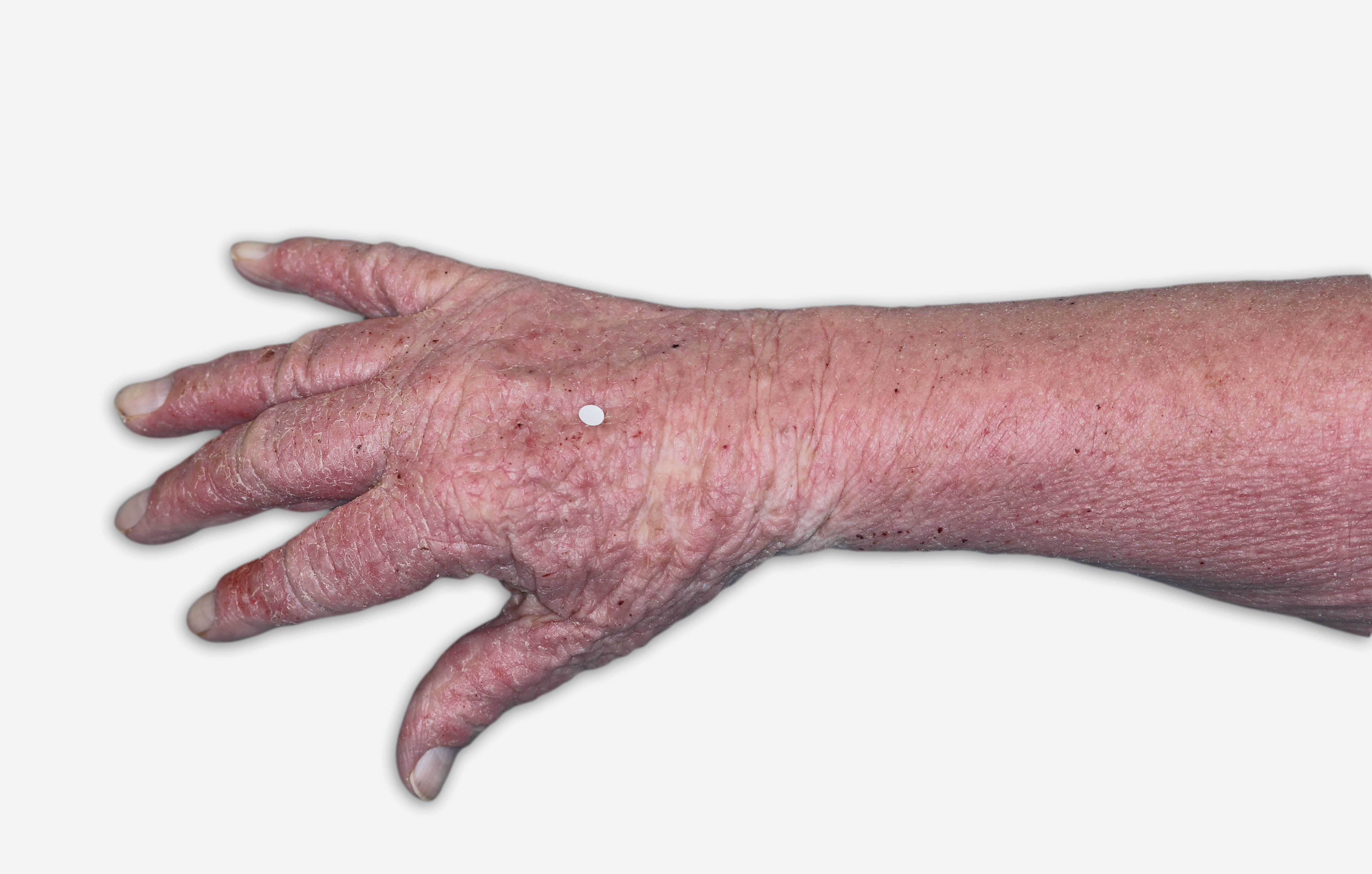 A patient image of the hand