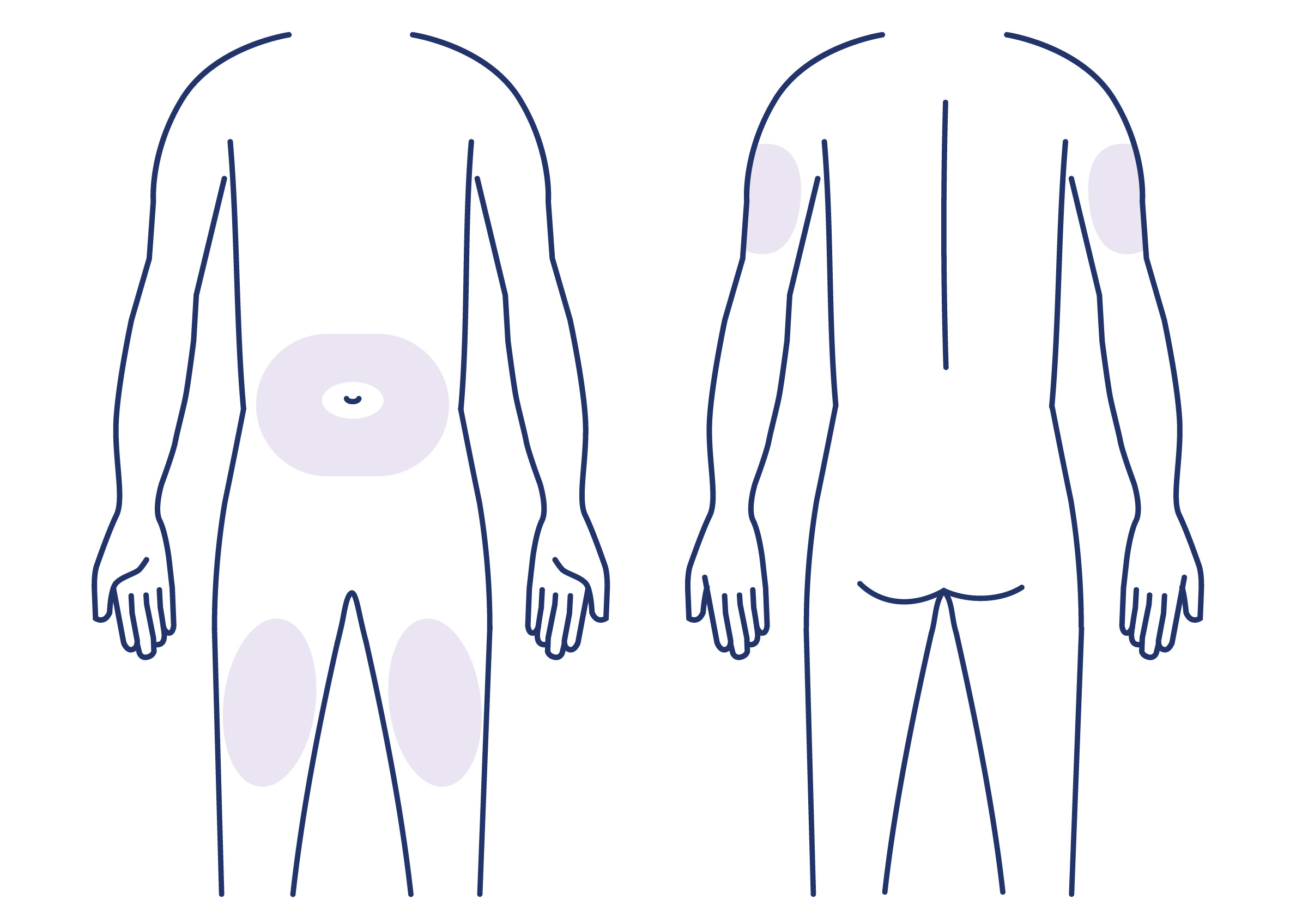 Injection site diagrams